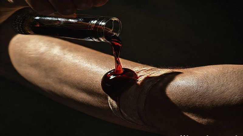 The Folly of Avarice: Road to Extinction